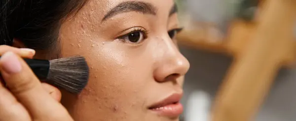 Gros plan de jeune femme asiatique avec la peau sujette à l'acné appliquant de la poudre visage, bannière problèmes de peau — Photo de stock