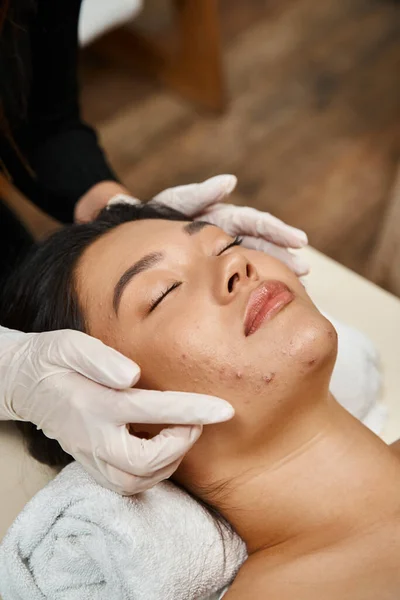 Massage facial pour peau sujette à l'acné, masseuse en gants de latex et femme asiatique aux yeux fermés — Photo de stock