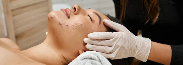 Massage facial pour peau sujette à l'acné, masseuse en gants et cliente asiatique aux yeux fermés, bannière — Photo de stock