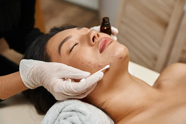Skin care treatment, therapist applying serum with cotton swab on asian woman with acne-prone skin — Stock Photo
