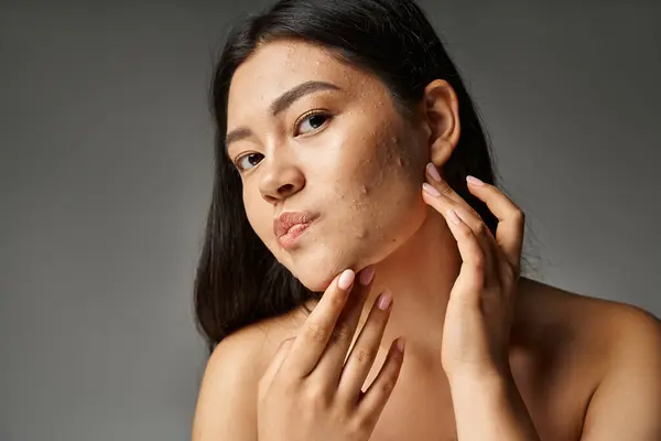 Молодая азиатская женщина с брюнетками и голыми плечами касаясь акне склонной кожи на сером фоне — стоковое фото