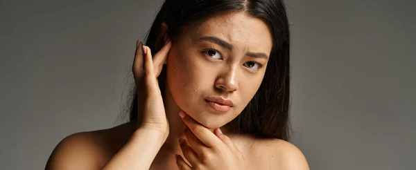 Worried young asian woman with bare shoulders and acne prone skin on grey backdrop, banner — Stock Photo
