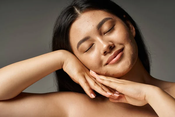 Jovem mulher asiática com problemas de pele e ombros nus sorrindo com olhos fechados no fundo cinza — Fotografia de Stock