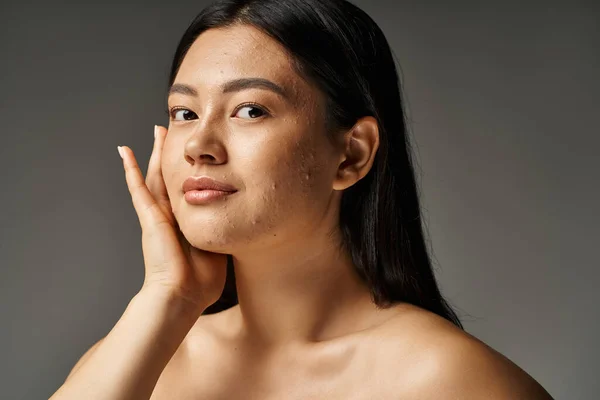Bonita jovem asiático mulher com pele problemas e nu ombros olhando para câmera no cinza fundo — Fotografia de Stock