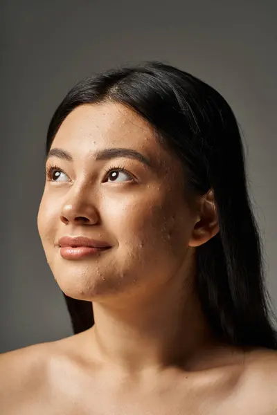 Rêveuse jeune femme asiatique avec des problèmes de peau et les épaules nues regardant vers le haut sur fond gris — Photo de stock