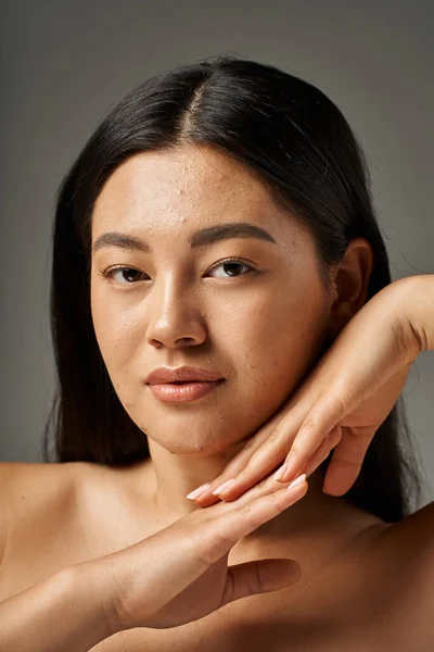 Brunette young asian woman with skin issues and bare shoulders looking at camera on grey background — Stock Photo