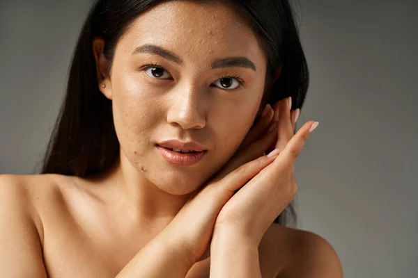 Brunette young asian girl with skin issues and bare shoulders looking at camera on grey background — Stock Photo