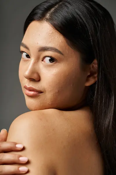 Молодая азиатка с брюнетками и прыщавой кожей, смотрящая на зеркало в ванной комнате, баннер — стоковое фото