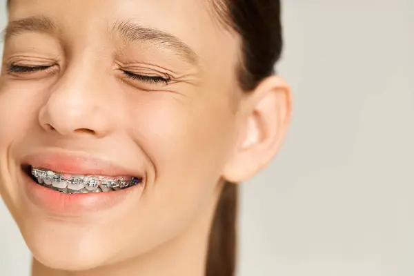 A stylish teenage girl with braces on her teeth smiles brightly, exuding confidence and charm. — Foto stock