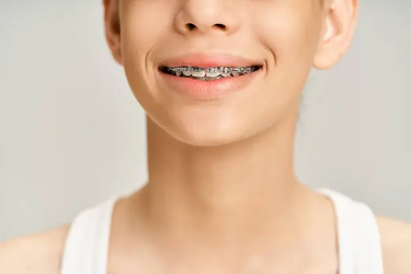 Una adolescente con estilo en traje vibrante sonriendo brillantemente, mostrando sus aparatos ortopédicos en sus dientes. - foto de stock