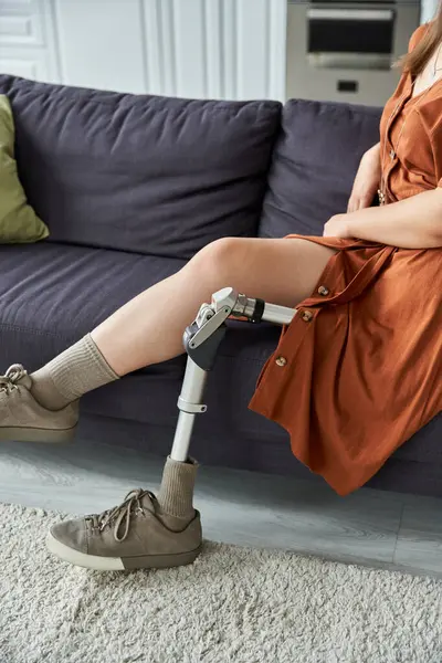 A woman with a prosthetic leg relaxes on a sofa, dressed in a stylish brown dress. — Stock Photo