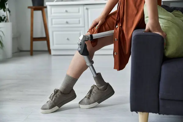 A woman with a prosthetic leg sits on a couch in a casual setting. — Stock Photo