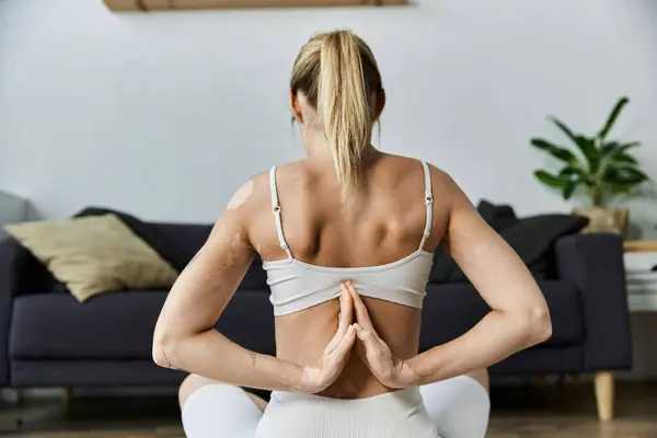 A young woman with vitiligo practices yoga in a modern apartment, finding peace and mindfulness. — Stock Photo