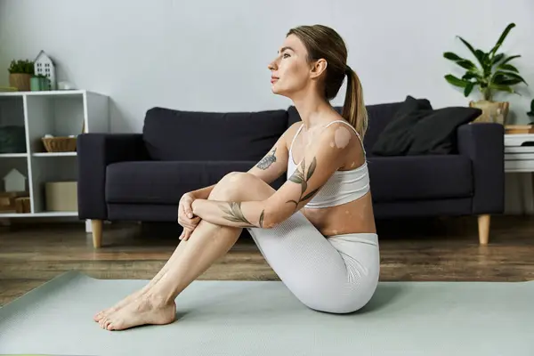 Une jeune femme avec du vitiligo s'assoit sur un tapis de yoga dans un appartement moderne, pratiquant une pose méditative. — Photo de stock