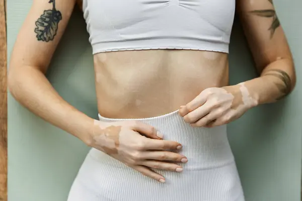 A young woman with vitiligo practices yoga in a modern apartment, adjusting her active wear before a meditation session. — Stock Photo