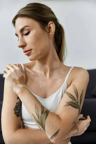 A young woman with vitiligo practices yoga in a modern apartment, focusing on her breath and finding inner peace. — Stock Photo