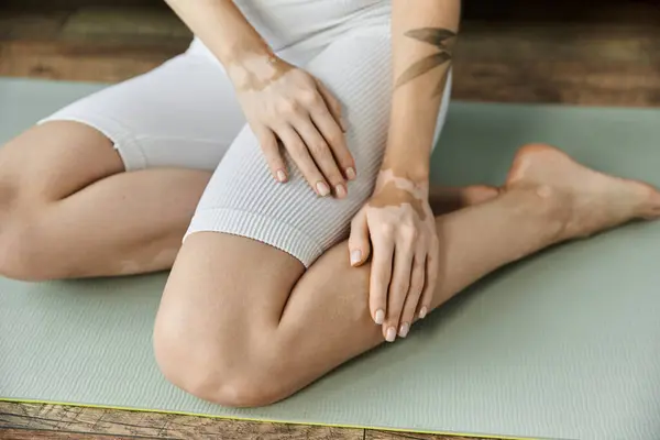 A young woman with vitiligo sits on a yoga mat in a modern apartment, practicing a seated pose. — Stock Photo