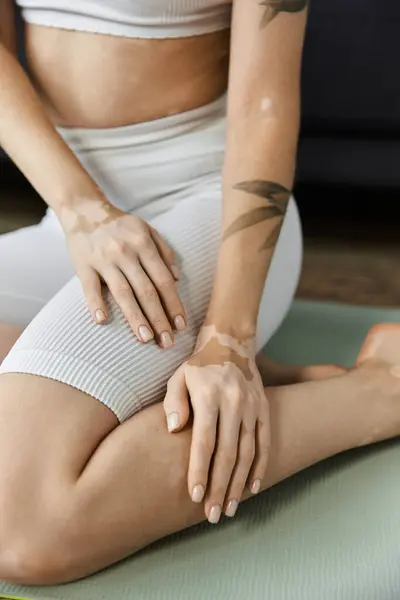 A young woman with vitiligo sits on a yoga mat in a contemporary living space, finding calm and balance through meditation. — Stock Photo