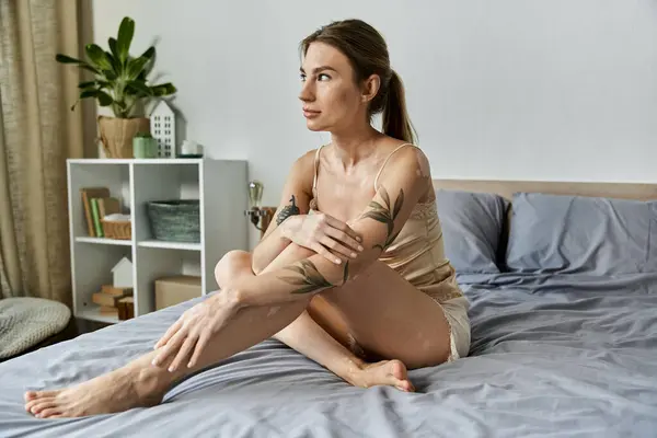 A young woman with vitiligo and a tattoo sits on her bed in a modern apartment, looking thoughtful and peaceful. — Stock Photo