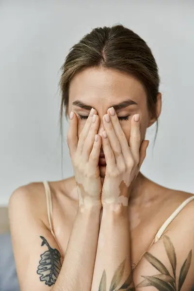 Eine junge Frau mit Vitiligo und Tätowierungen sitzt in ihrem gemütlichen Schlafzimmer, verloren in Gedanken, während sie ihren Kopf in den Händen hält. — Stockfoto