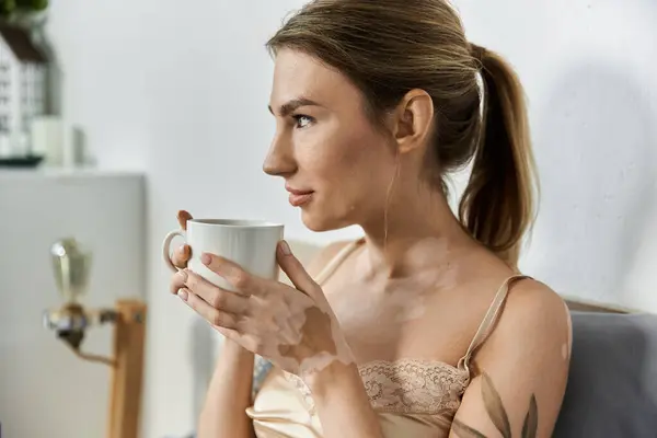 Uma jovem mulher com vitiligo goza de uma xícara de café em seu quarto, banhado na luz da manhã. — Fotografia de Stock