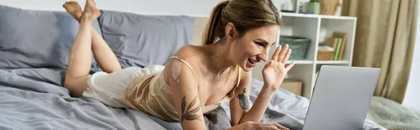 Una joven con vitiligo y un tatuaje se encuentra en la cama, sonriendo y saludando a la pantalla de un ordenador portátil. - foto de stock