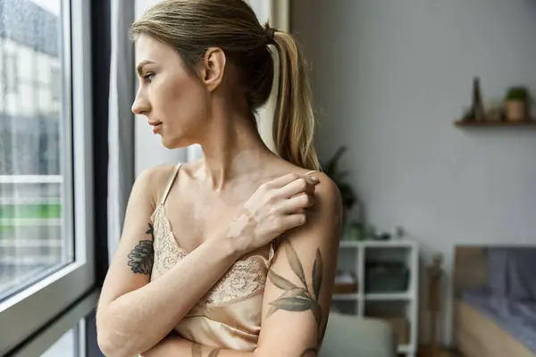 Une jeune femme avec du vitiligo et un tatouage se tient près d'une fenêtre dans sa chambre, regardant dehors. — Photo de stock