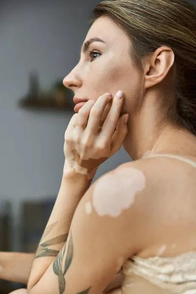 A young woman with vitiligo and a tattoo sits in her cozy bedroom, lost in thought. — Stock Photo