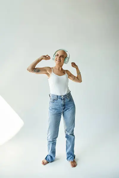 Una giovane donna con l'alopecia sorride brillantemente mentre mostra la sua forza e fiducia. — Foto stock