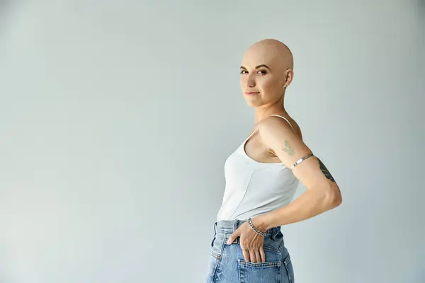 Una joven con alopecia se destaca orgullosamente, mostrando su belleza única en un entorno sereno. — Stock Photo