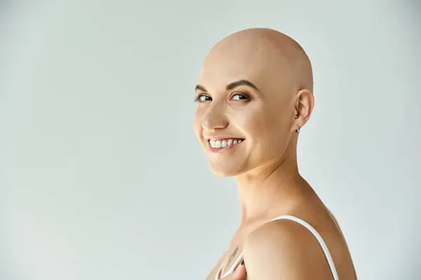 A young bald woman with alopecia radiates confidence, smiling warmly in soft light. — Stock Photo