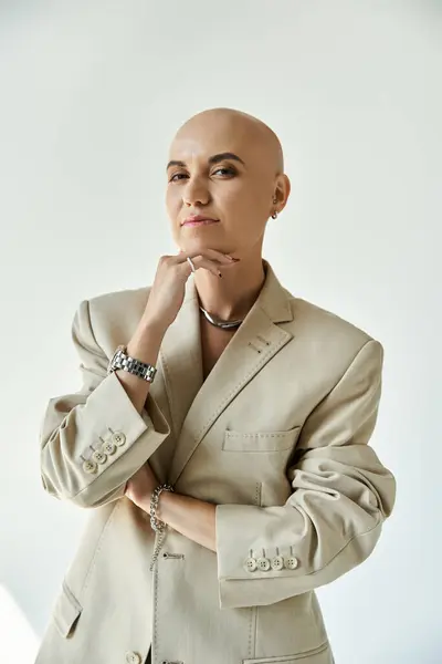 A confident young woman with alopecia shines in stylish beige attire, showcasing her beauty. — Stock Photo