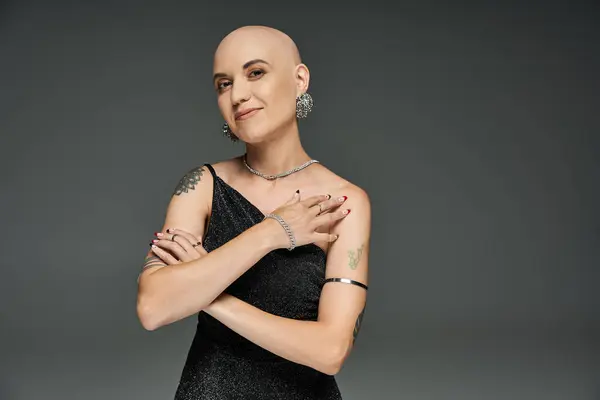 A young bald woman with alopecia poses gracefully, exuding strength and elegance. — Stock Photo