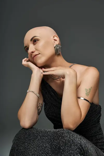 A young bald woman with alopecia elegantly poses in a black dress, showcasing confidence and grace. — Stock Photo