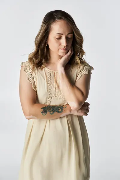 Young woman with vitiligo in a cream dress poses thoughtfully, highlighting her beauty. — Stock Photo