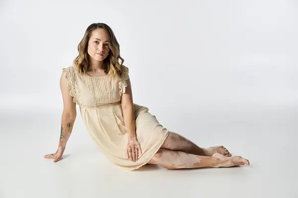 Young woman with vitiligo poses gracefully, showcasing her unique skin and beauty. — Stock Photo
