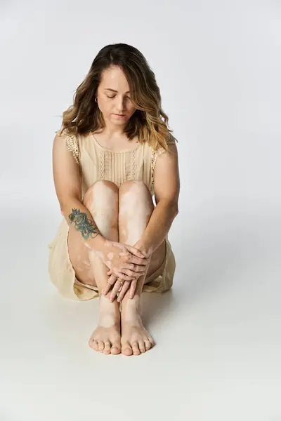A young woman with vitiligo sits thoughtfully while embracing her unique skin pattern. — Stock Photo