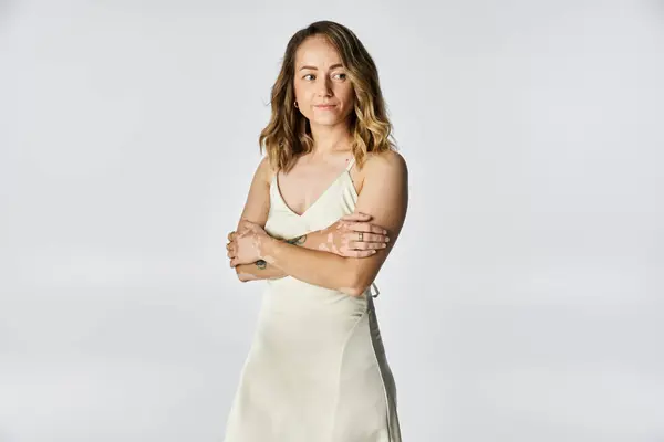 Young woman with vitiligo stands gracefully in a well lit studio, showcasing her beauty. — Stock Photo