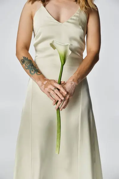 A young woman with vitiligo elegantly poses with a calla lily in a cream dress. — Stock Photo