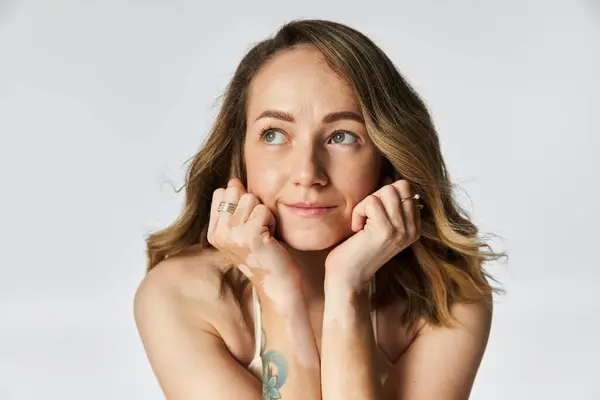 Jeune femme avec vitiligo affiche une expression réfléchie tout en se reposant à la maison. — Photo de stock