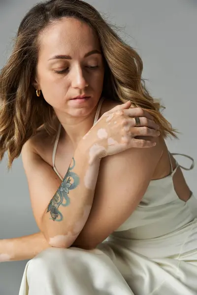 Jeune femme avec vitiligo pose élégamment, soulignant sa beauté unique et ses caractéristiques délicates. — Photo de stock