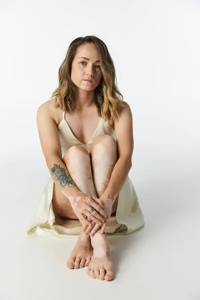 Young woman with vitiligo sits gracefully, showcasing her unique skin and features. — Stock Photo