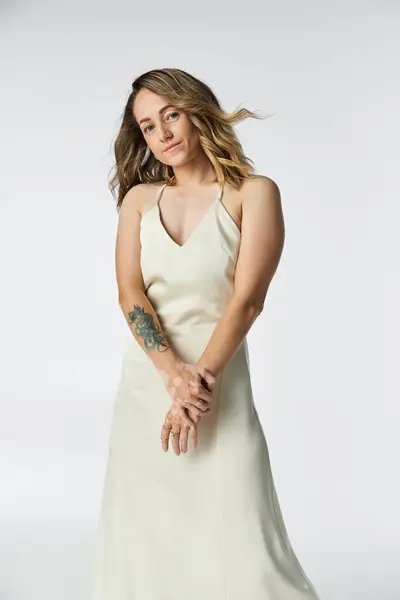 A young woman with vitiligo smiles confidently in a light colored dress. — Stock Photo