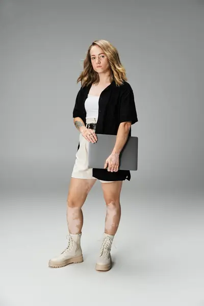 Confident young woman with vitiligo holds a laptop, stylishly standing tall. — Stock Photo