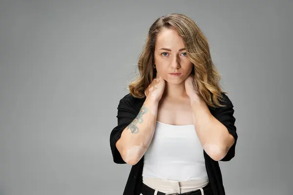 Young woman with vitiligo showcases her beauty while posing against a neutral grey backdrop. — Stock Photo