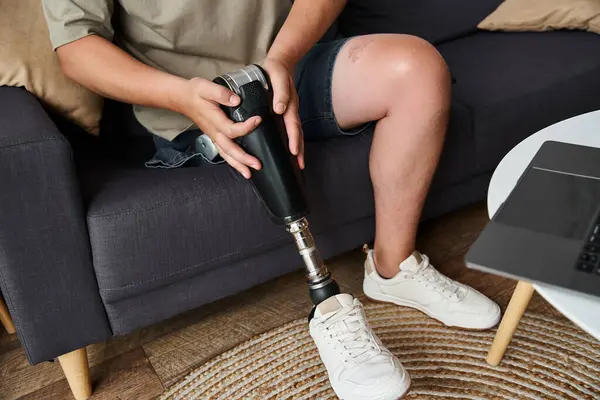 Handsome young man relaxes on a couch, adjusting his prosthetic leg with focus and care. — Stock Photo
