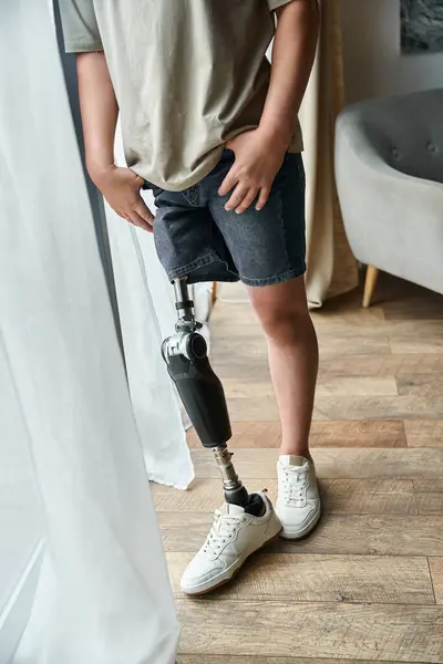 A young, attractive man stands confidently with his visible prosthetic leg in a modern living room. — Stock Photo