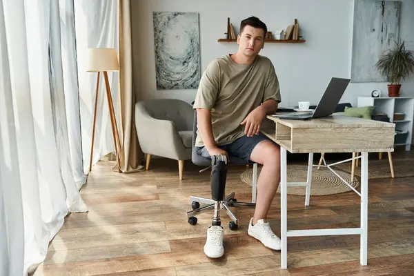 Young man with prosthetic leg works at desk in contemporary room filled with natural light. — Stock Photo
