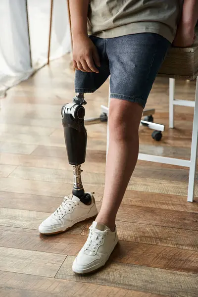 A young handsome man is confidently seated with a prosthetic leg on display, styled in casual wear. — Stock Photo