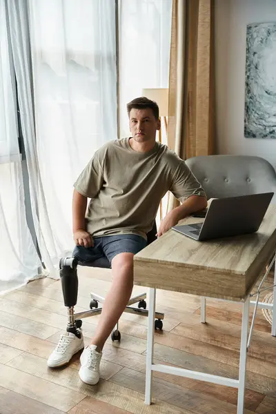 Young handsome man with prosthetic leg sits at a desk working on a laptop in a bright room. — Stock Photo